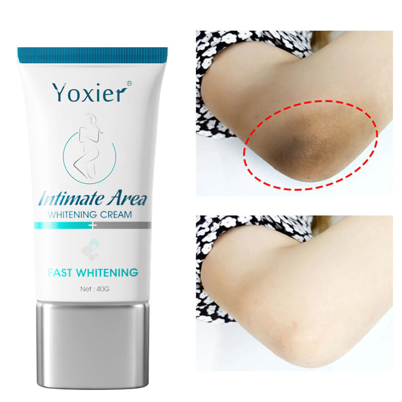 Intimate Area Whitening Cream Brighten Repair Armpit Elbow Buttocks Moisturizing Nourish Nicotinamide Body Skin Care Intimate Area Whitening Cream Brighten Repair Armpit Elbow Buttocks Moisturizing Nourish Nicotinamide Body Skin Care